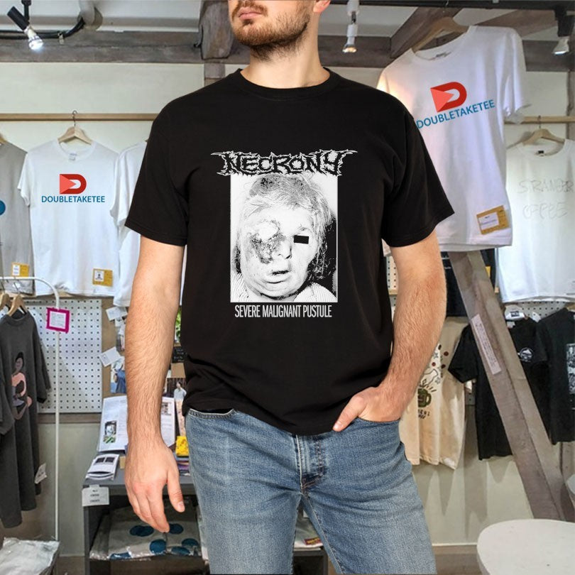 Official Necrony Severe Malignant Pustule Shirts
