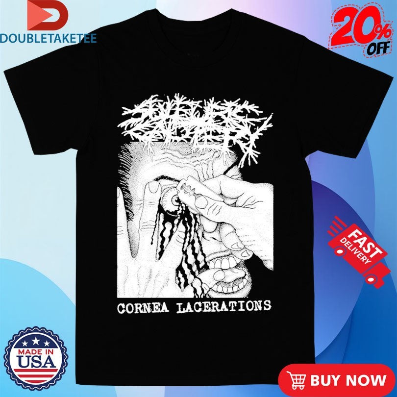 Official Sulfuric Cautery Cornea Lacerations Shirts